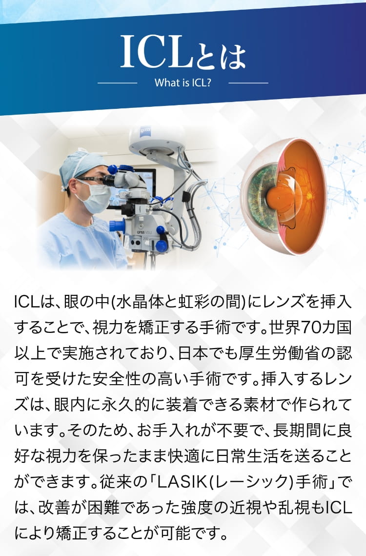 ICLとは